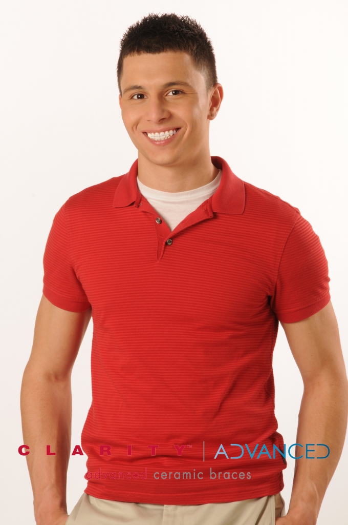 ClarityADV Red Shirt Man Clear Braces1