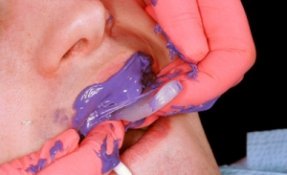 messy putty impression